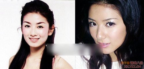 娱乐圈女明星大饼脸惊变锥子